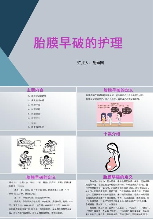 phprom技巧_胎膜早破的诊断与处理