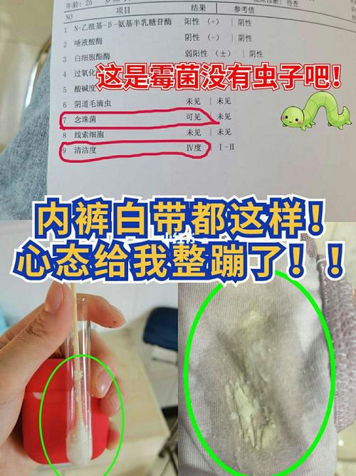yfyfpcphp技巧_这些虫子虽然个子小但咱还真不能小瞧了它们